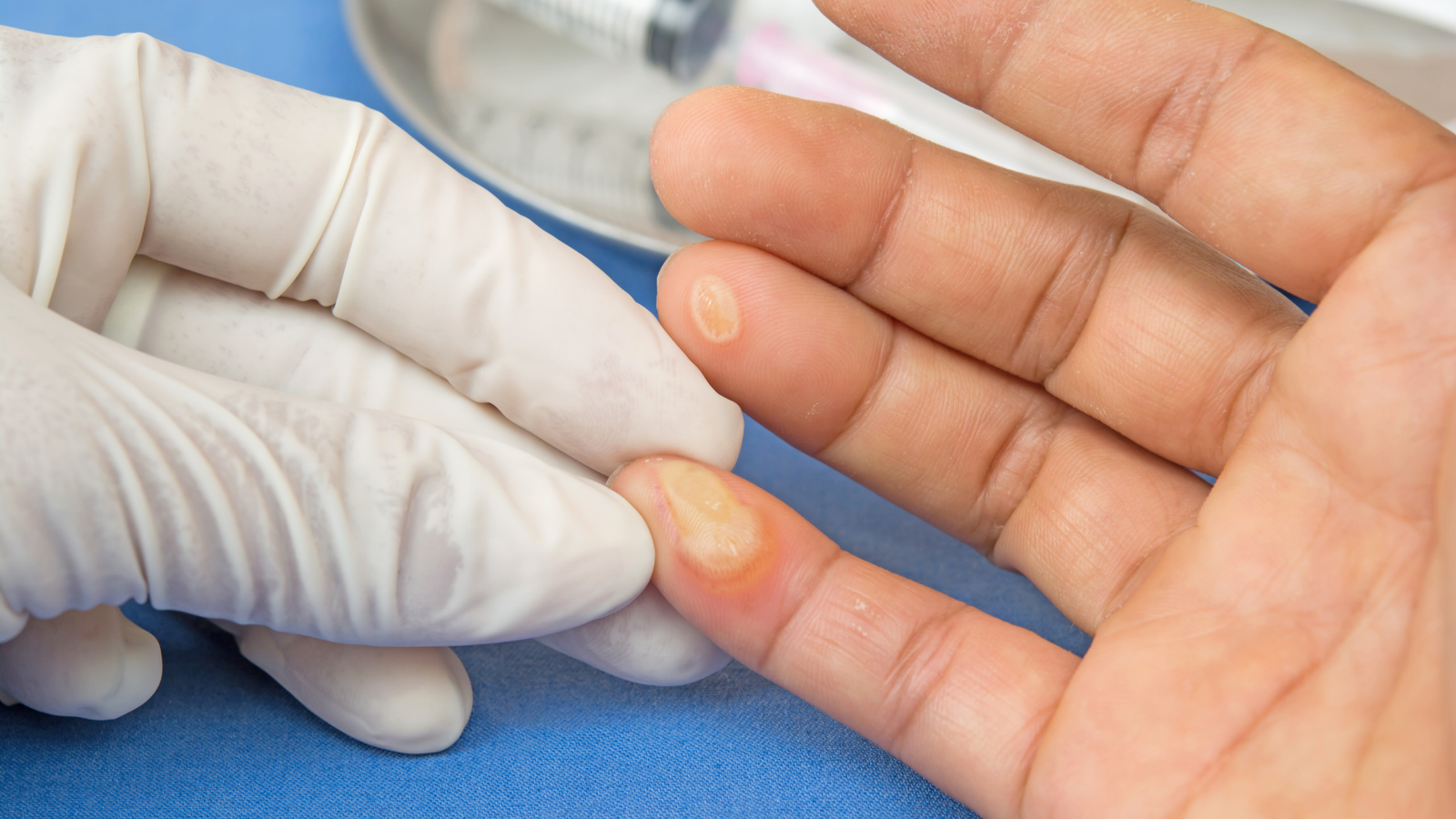 Cuidado de la piel y eliminación de imperfecciones