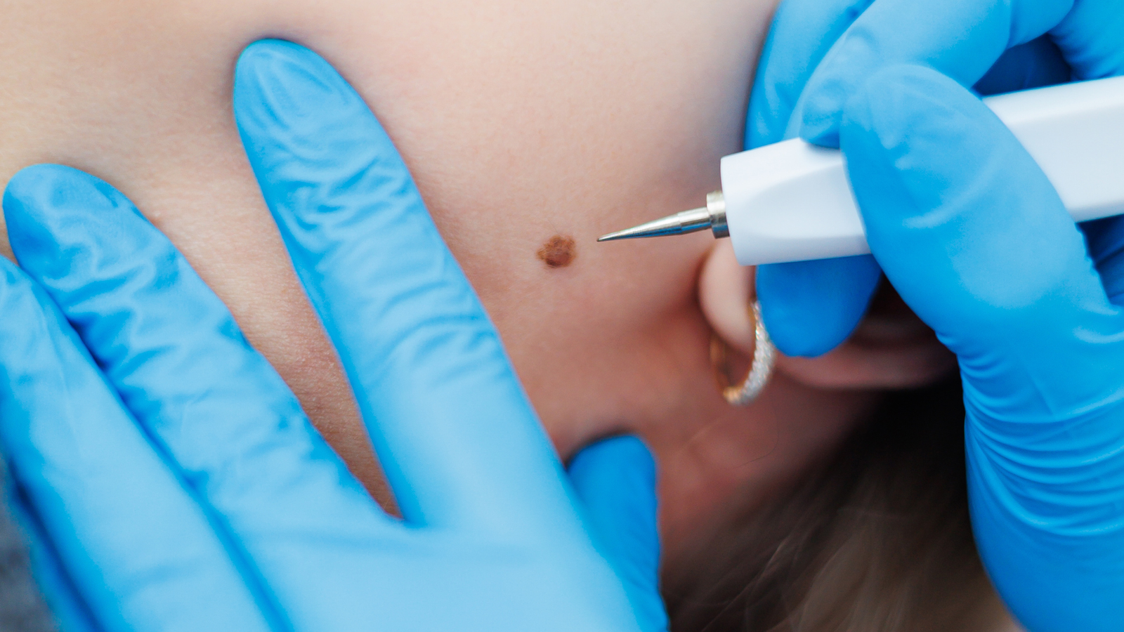 Equipo clínico e instrumental esterilizado para estética